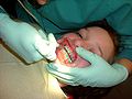 Cheap Dental Insurance Plan