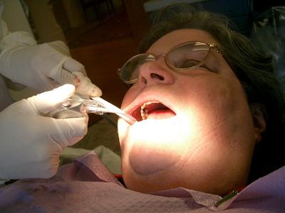 Aetna Dental Insurance Plan